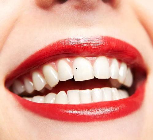 成人牙缝修复方法视频,成人牙缝修复方法视频深度解析