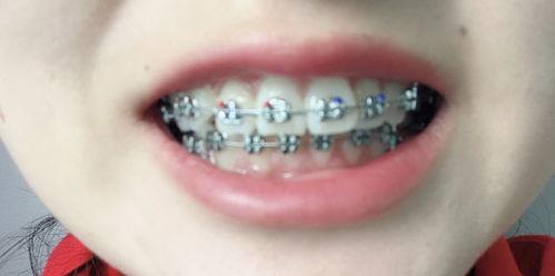 成人牙齿养护方法视频大全,视频大全精华汇总